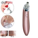 میکرودرم خانگی مدل xn-8030