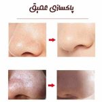 میکرودرم گلویش استایل مدل MR-69