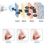 میکرودرم خانگی مدل BLACK HEAD22